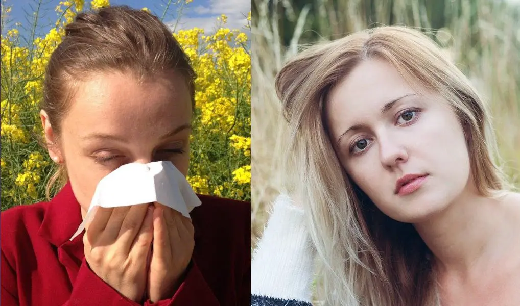 Women suffering from allergies